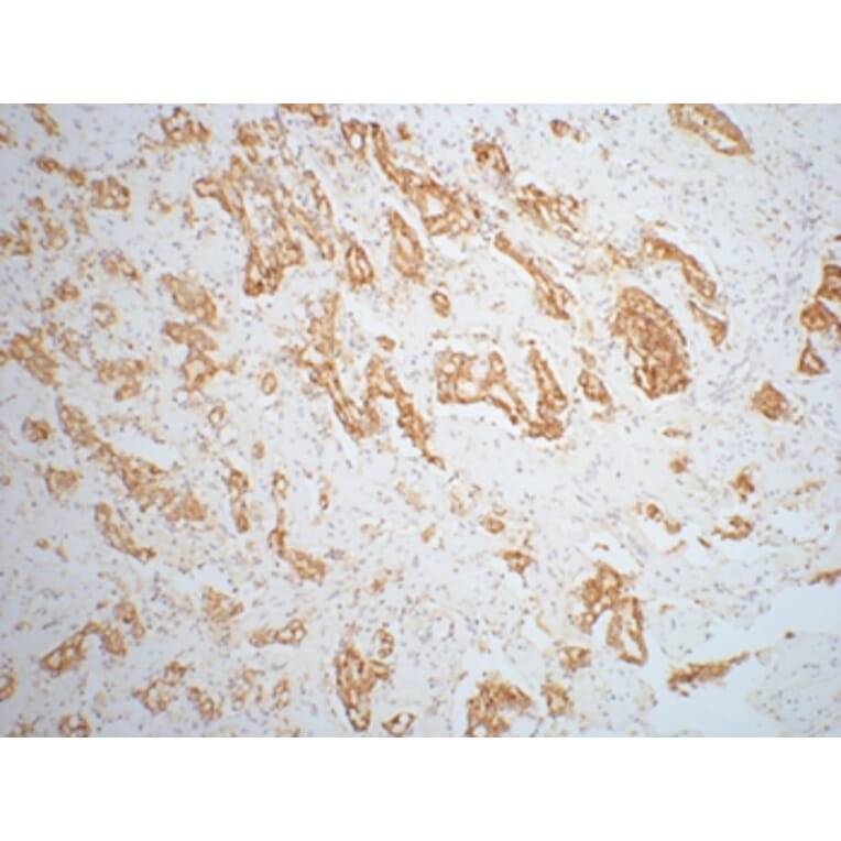 AMACR/P504S Mouse Monoclonal Antibody from Signalway Antibody (37999) - Antibodies.com