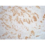 AMACR/P504S Mouse Monoclonal Antibody from Signalway Antibody (37999) - Antibodies.com