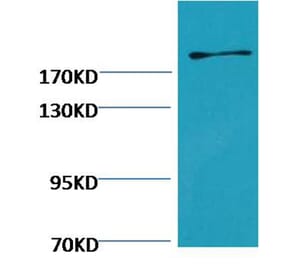 Western blot - Fibronectin Mouse Monoclonal Antibody from Signalway Antibody (38073) - Antibodies.com