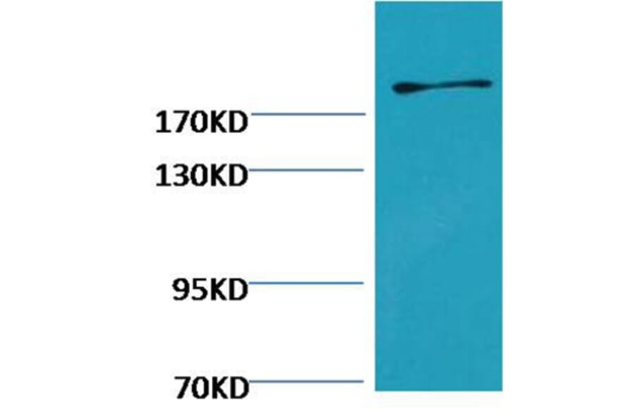 Western blot - Fibronectin Mouse Monoclonal Antibody from Signalway Antibody (38073) - Antibodies.com
