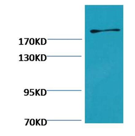 Western blot - Fibronectin Mouse Monoclonal Antibody from Signalway Antibody (38073) - Antibodies.com