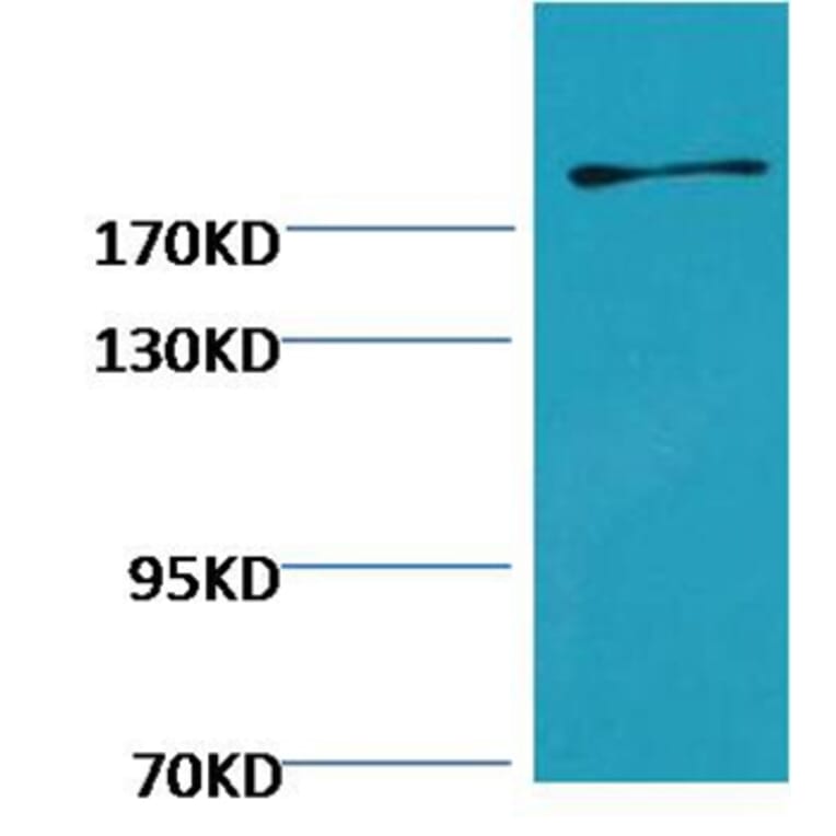 Western blot - Fibronectin Mouse Monoclonal Antibody from Signalway Antibody (38073) - Antibodies.com