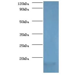 Myelin P2 protein Polyclonal Antibody from Signalway Antibody (42496) - Antibodies.com
