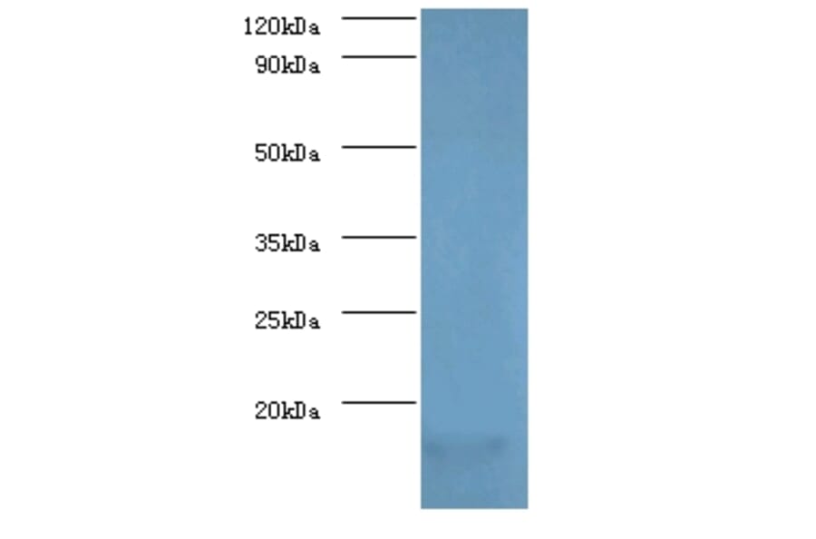 Myelin P2 protein Polyclonal Antibody from Signalway Antibody (42496) - Antibodies.com
