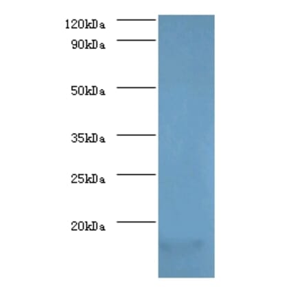 Myelin P2 protein Polyclonal Antibody from Signalway Antibody (42496) - Antibodies.com