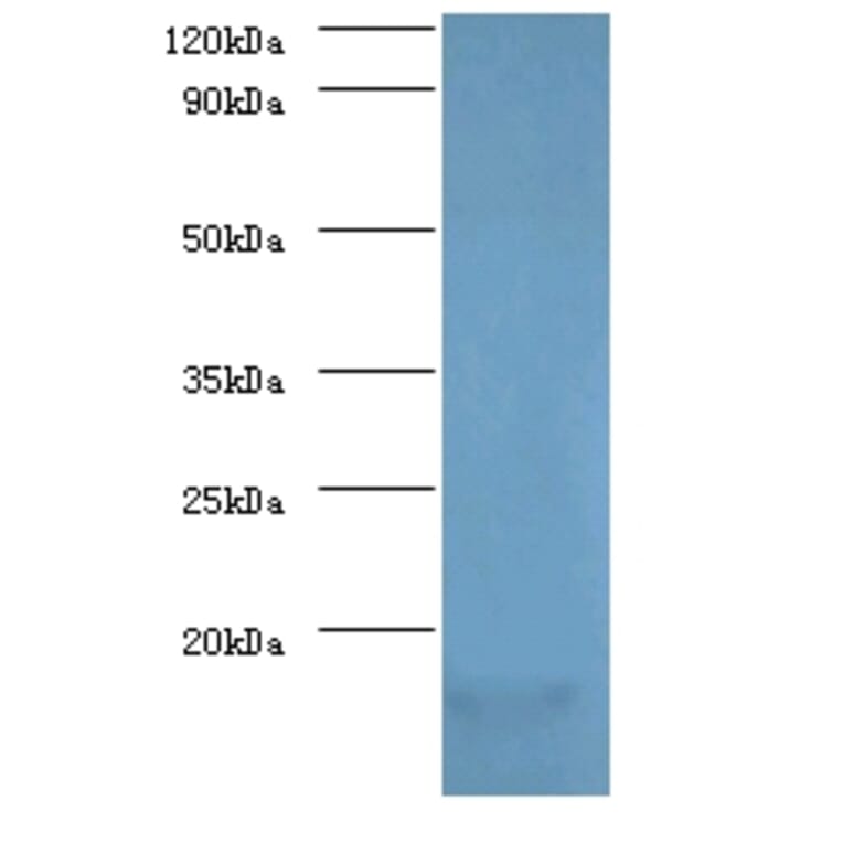 Myelin P2 protein Polyclonal Antibody from Signalway Antibody (42496) - Antibodies.com