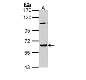 RBMY1A1 antibody from Signalway Antibody (22011) - Antibodies.com