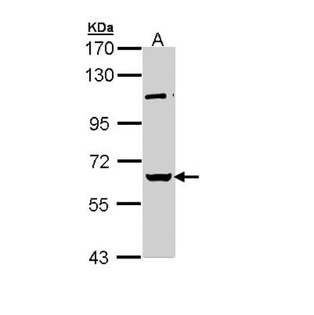 RBMY1A1 antibody from Signalway Antibody (22011) - Antibodies.com