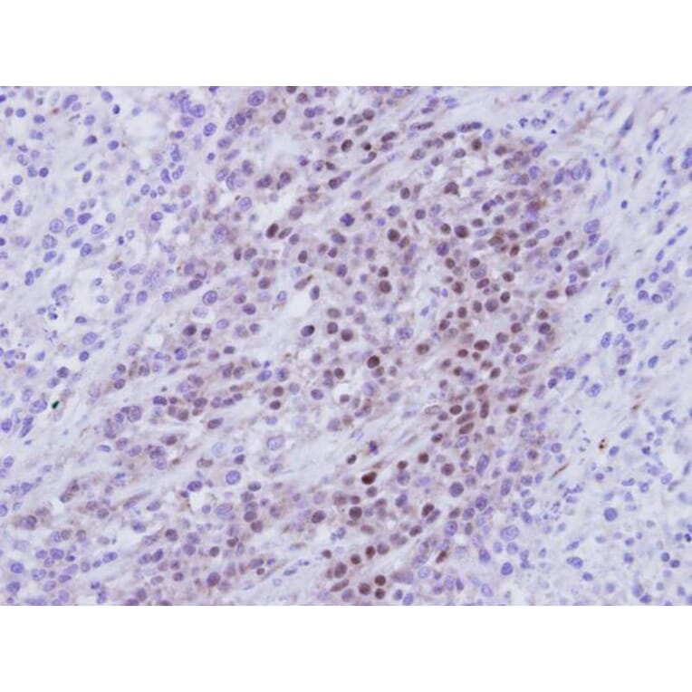 Immunohistochemistry - RBMY1A1 antibody from Signalway Antibody (22011) - Antibodies.com