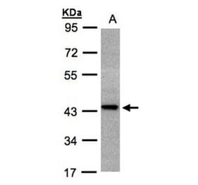 ST3GAL2 antibody from Signalway Antibody (22029) - Antibodies.com