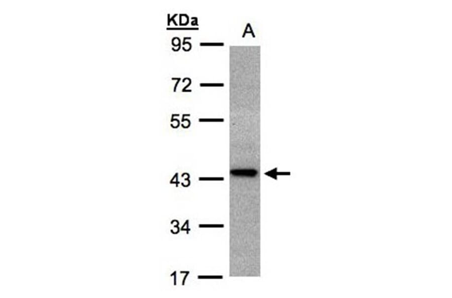 ST3GAL2 antibody from Signalway Antibody (22029) - Antibodies.com