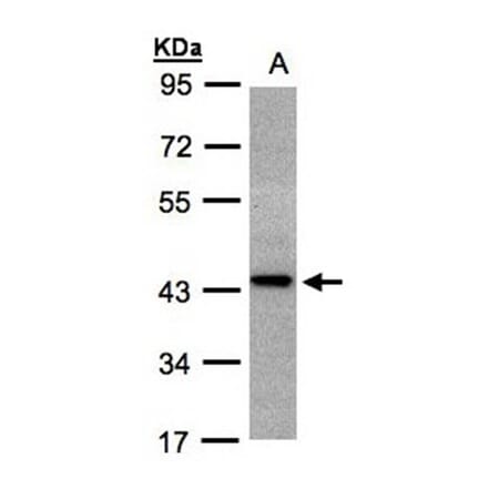 ST3GAL2 antibody from Signalway Antibody (22029) - Antibodies.com