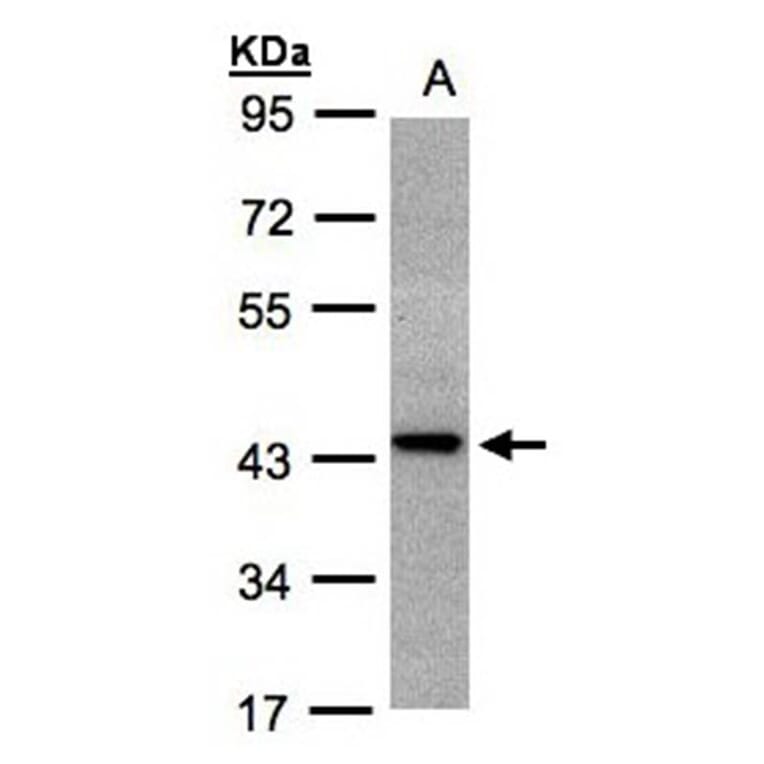 ST3GAL2 antibody from Signalway Antibody (22029) - Antibodies.com