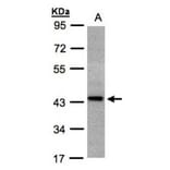 ST3GAL2 antibody from Signalway Antibody (22029) - Antibodies.com