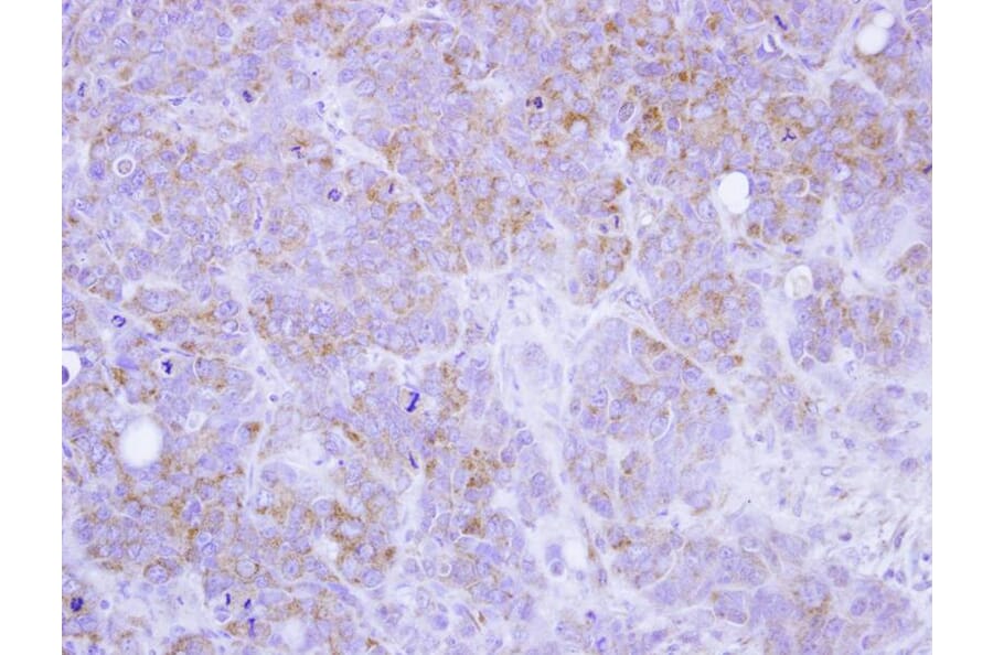 Immunohistochemistry - ST3GAL2 antibody from Signalway Antibody (22029) - Antibodies.com