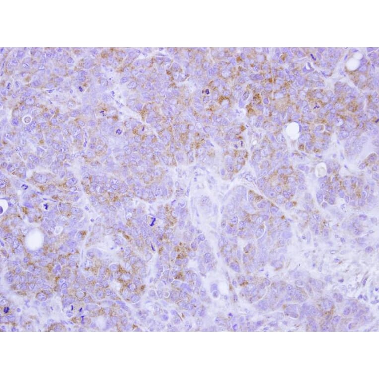 Immunohistochemistry - ST3GAL2 antibody from Signalway Antibody (22029) - Antibodies.com
