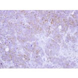 Immunohistochemistry - ST3GAL2 antibody from Signalway Antibody (22029) - Antibodies.com