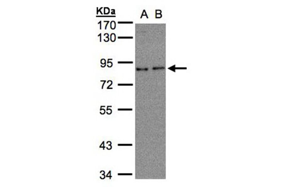 ZYG11BL antibody from Signalway Antibody (22107) - Antibodies.com