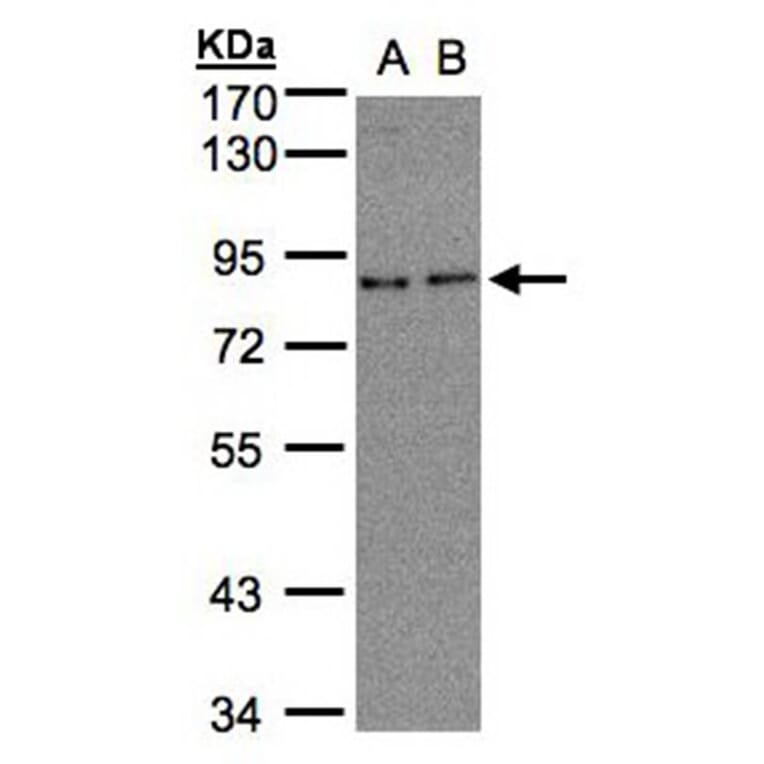 ZYG11BL antibody from Signalway Antibody (22107) - Antibodies.com