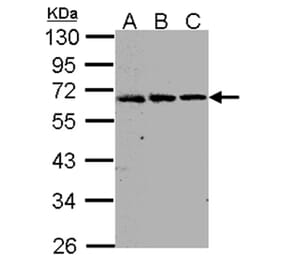 FGFR-5 antibody from Signalway Antibody (22119) - Antibodies.com