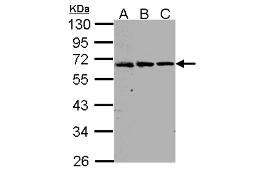 FGFR-5 antibody from Signalway Antibody (22119) - Antibodies.com