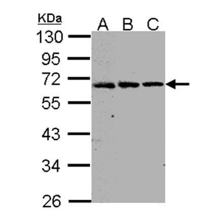 FGFR-5 antibody from Signalway Antibody (22119) - Antibodies.com
