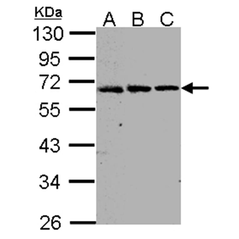 FGFR-5 antibody from Signalway Antibody (22119) - Antibodies.com
