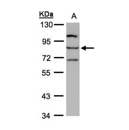 e-LOX-3 antibody from Signalway Antibody (22123) - Antibodies.com