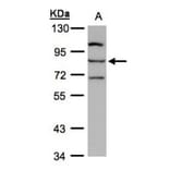 e-LOX-3 antibody from Signalway Antibody (22123) - Antibodies.com