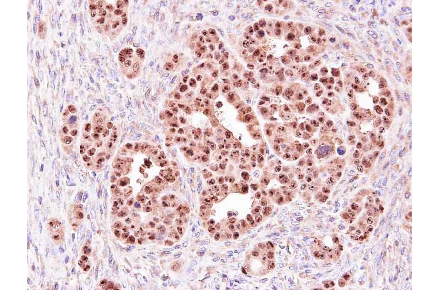 Immunohistochemistry - e-LOX-3 antibody from Signalway Antibody (22123) - Antibodies.com
