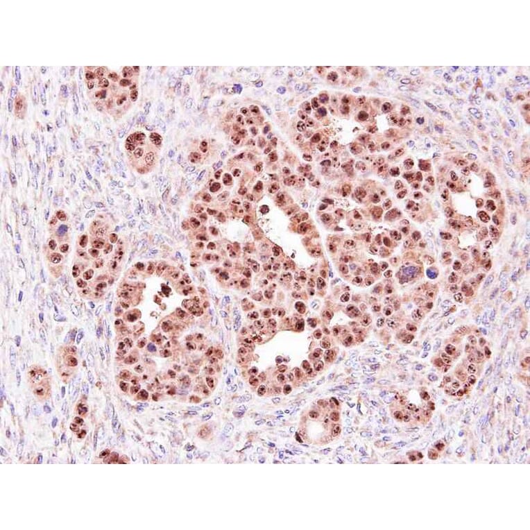 Immunohistochemistry - e-LOX-3 antibody from Signalway Antibody (22123) - Antibodies.com
