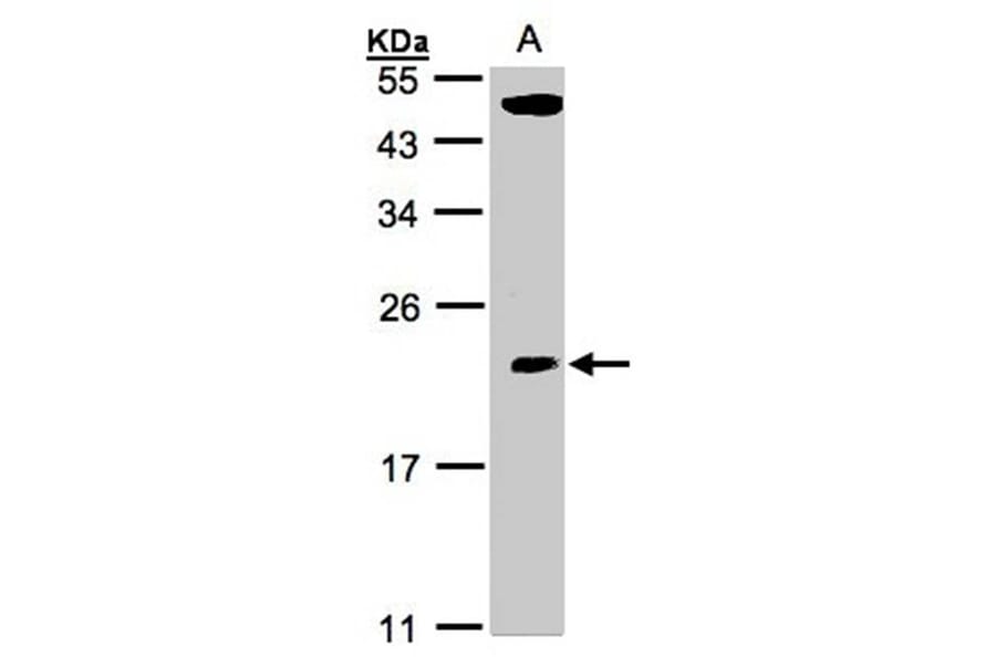 CGI-121 antibody from Signalway Antibody (22213) - Antibodies.com