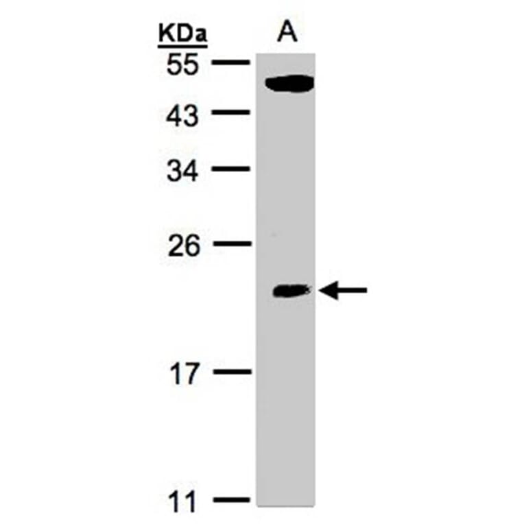 CGI-121 antibody from Signalway Antibody (22213) - Antibodies.com