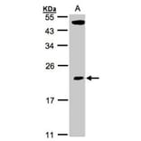 CGI-121 antibody from Signalway Antibody (22213) - Antibodies.com