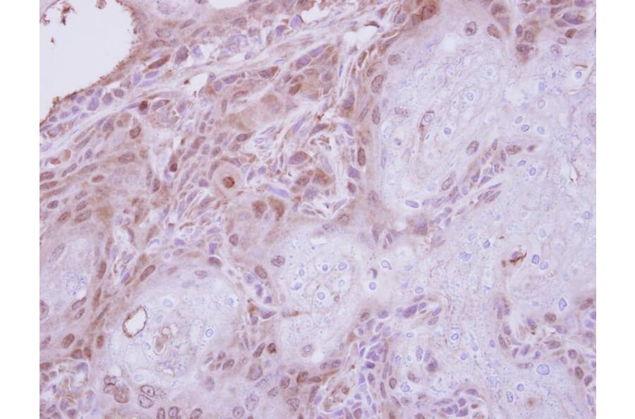 Immunohistochemistry - CGI-121 antibody from Signalway Antibody (22213) - Antibodies.com