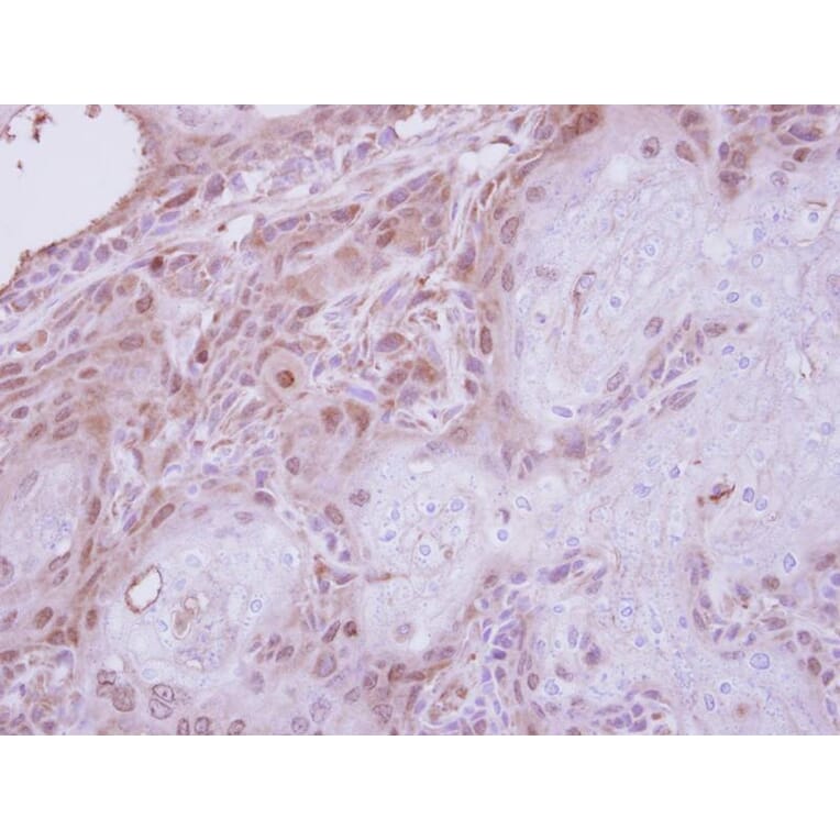 Immunohistochemistry - CGI-121 antibody from Signalway Antibody (22213) - Antibodies.com