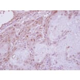 Immunohistochemistry - CGI-121 antibody from Signalway Antibody (22213) - Antibodies.com