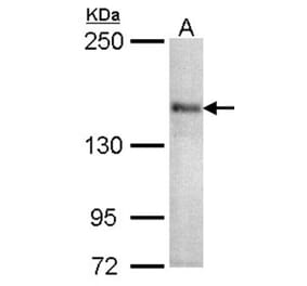 CACNA1S antibody from Signalway Antibody (22326) - Antibodies.com