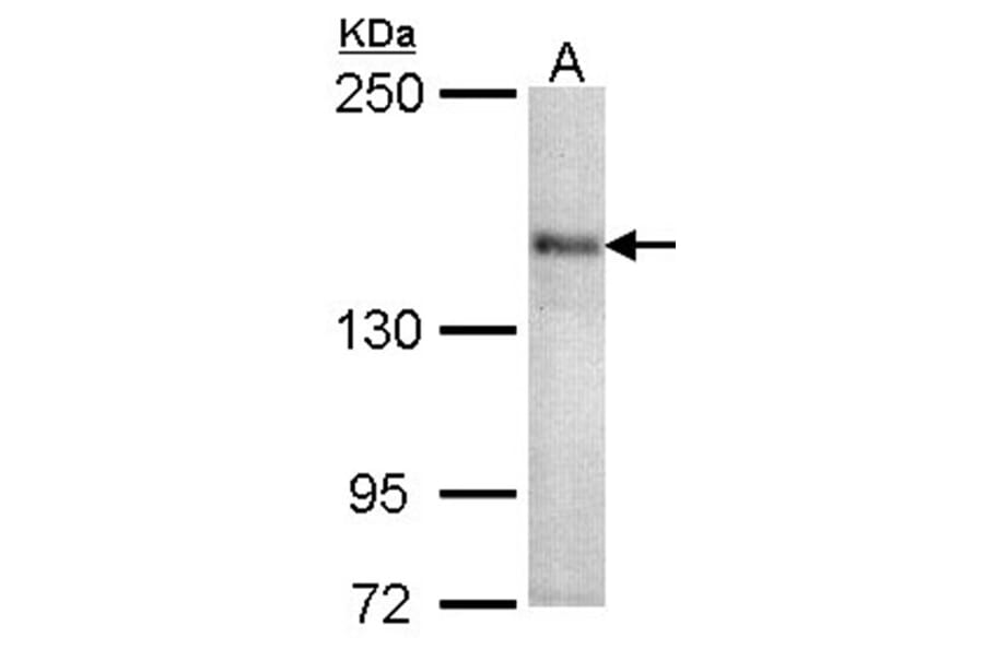 CACNA1S antibody from Signalway Antibody (22326) - Antibodies.com