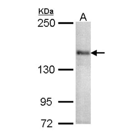 CACNA1S antibody from Signalway Antibody (22326) - Antibodies.com