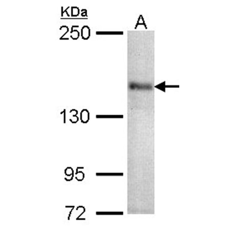 CACNA1S antibody from Signalway Antibody (22326) - Antibodies.com