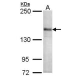 CACNA1S antibody from Signalway Antibody (22326) - Antibodies.com