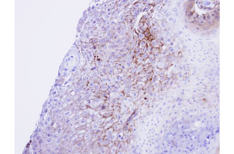 Immunohistochemistry - CACNA1S antibody from Signalway Antibody (22326) - Antibodies.com