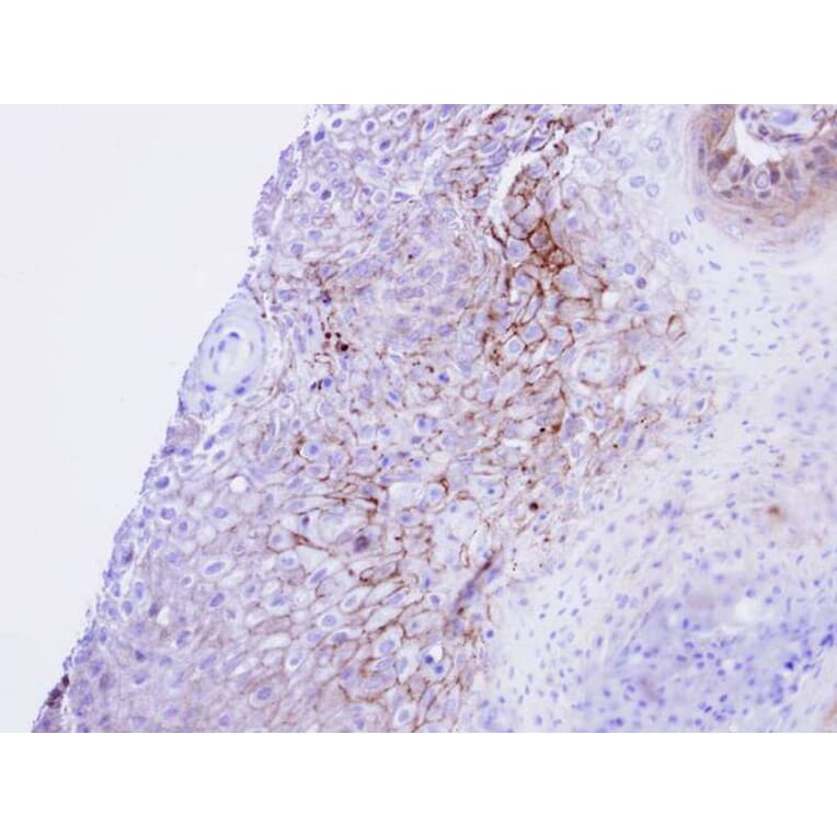 Immunohistochemistry - CACNA1S antibody from Signalway Antibody (22326) - Antibodies.com