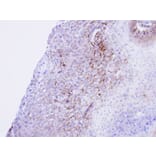 Immunohistochemistry - CACNA1S antibody from Signalway Antibody (22326) - Antibodies.com