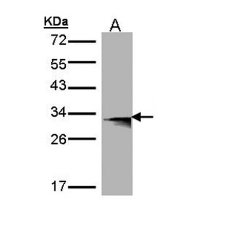 Western blot - HLA-DMB antibody from Signalway Antibody (22356) - Antibodies.com