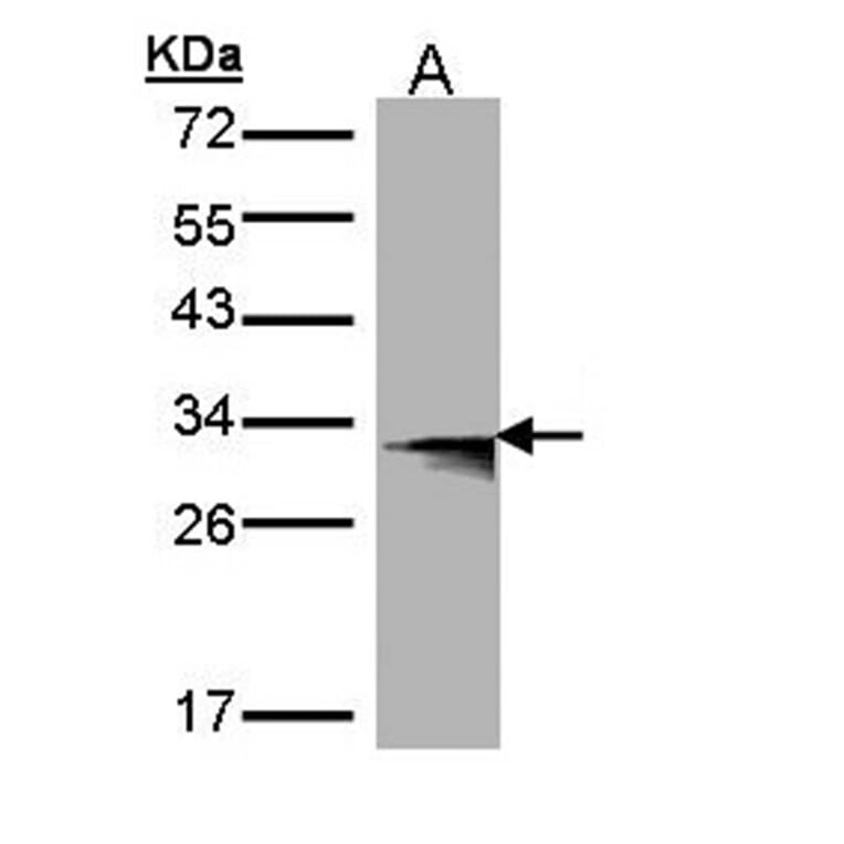 Western blot - HLA-DMB antibody from Signalway Antibody (22356) - Antibodies.com