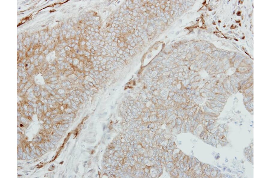 Immunohistochemistry - HLA-DMB antibody from Signalway Antibody (22356) - Antibodies.com