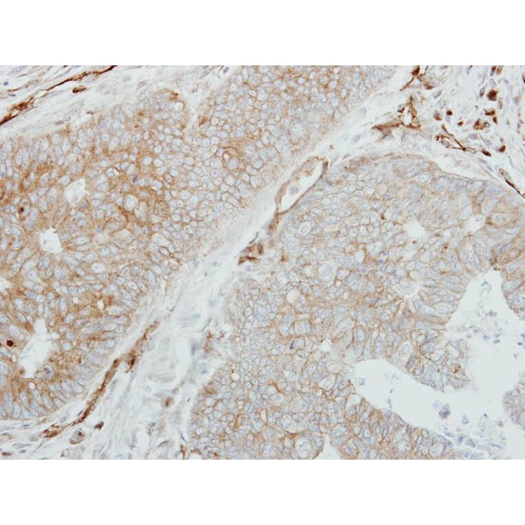 Immunohistochemistry - HLA-DMB antibody from Signalway Antibody (22356) - Antibodies.com