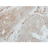 Immunohistochemistry - HLA-DMB antibody from Signalway Antibody (22356) - Antibodies.com